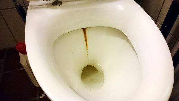 Rensning af brune belægninger i wc